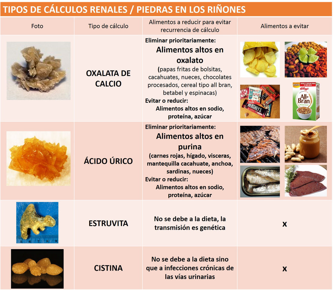 Agua dura y sus efectos a la salud - parte 2 cálculos renales (piedras en riñones)